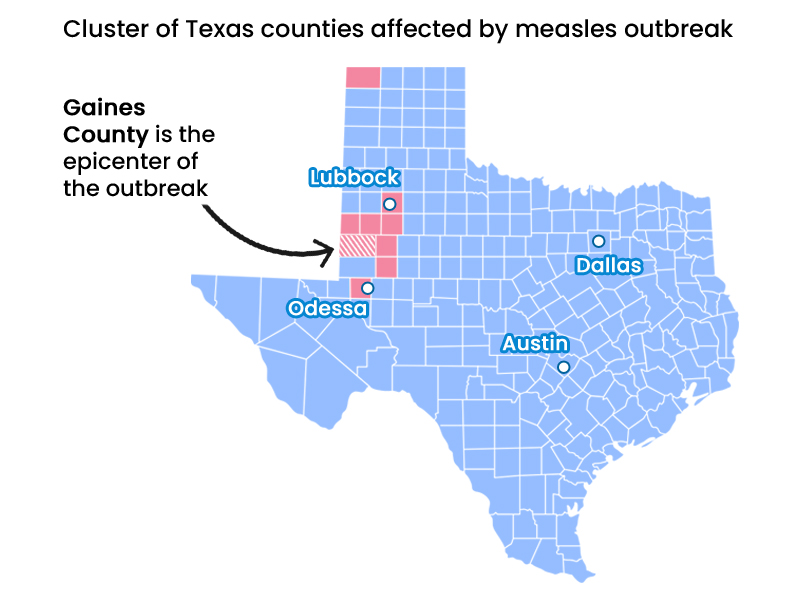 Texas counties affected by measles outbreak